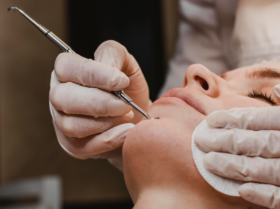 Limpeza de pele: 4 pontos que exigem atenção